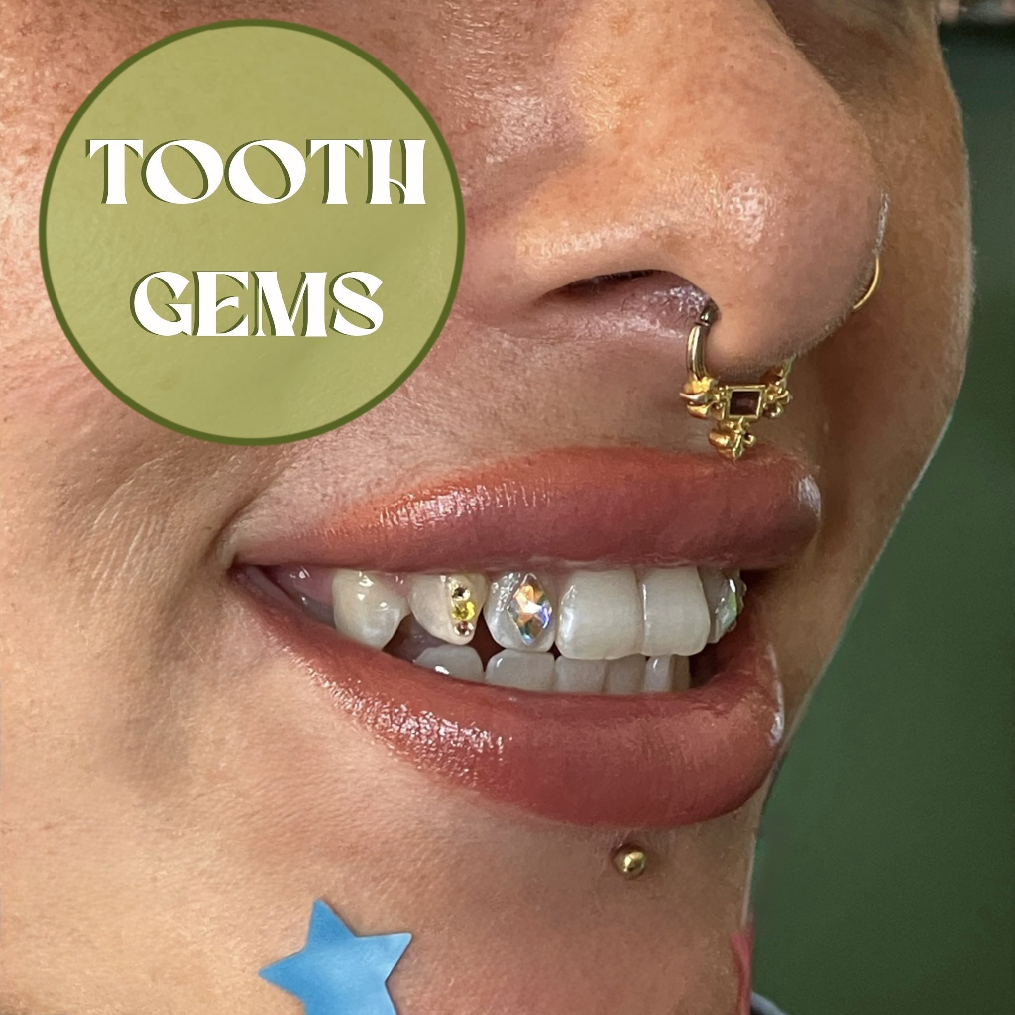 Tooth gems gallery card image