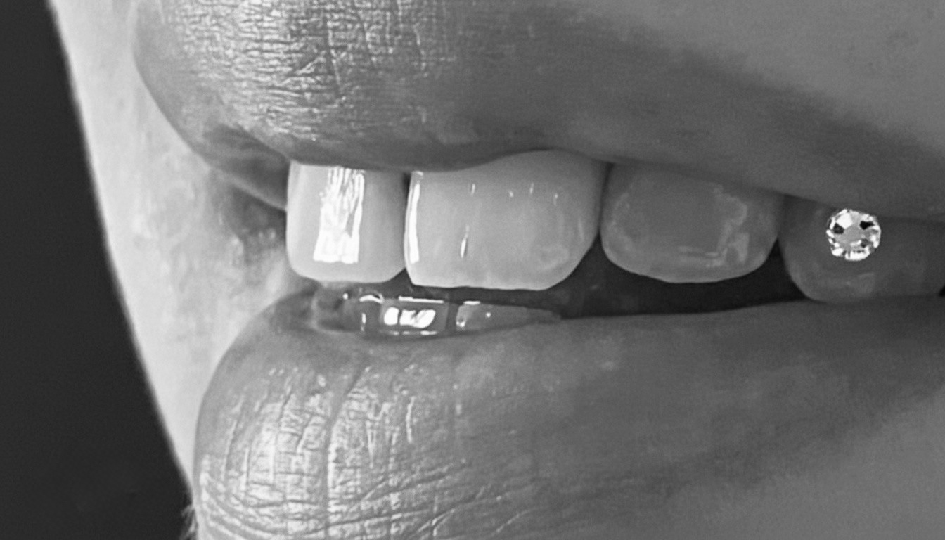 Tooth gems